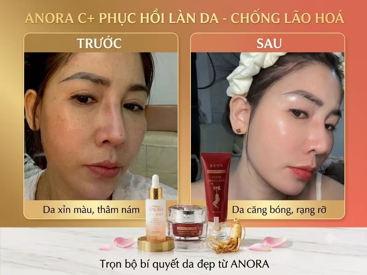 Bộ sản phẩm Anora C+ phục hồi làn da, chống lão hoá tại Mai Hoa Phú Thọ